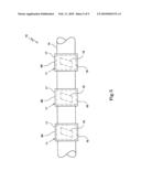 Process of Manufacturing a Medical Use Electrical Lead diagram and image