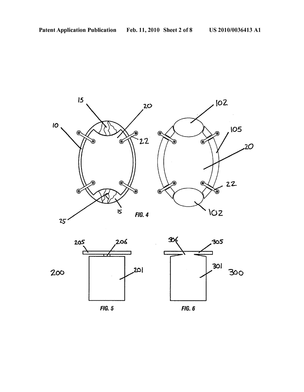 KERF CRANIAL CLOSURE METHODS AND DEVICE - diagram, schematic, and image 03