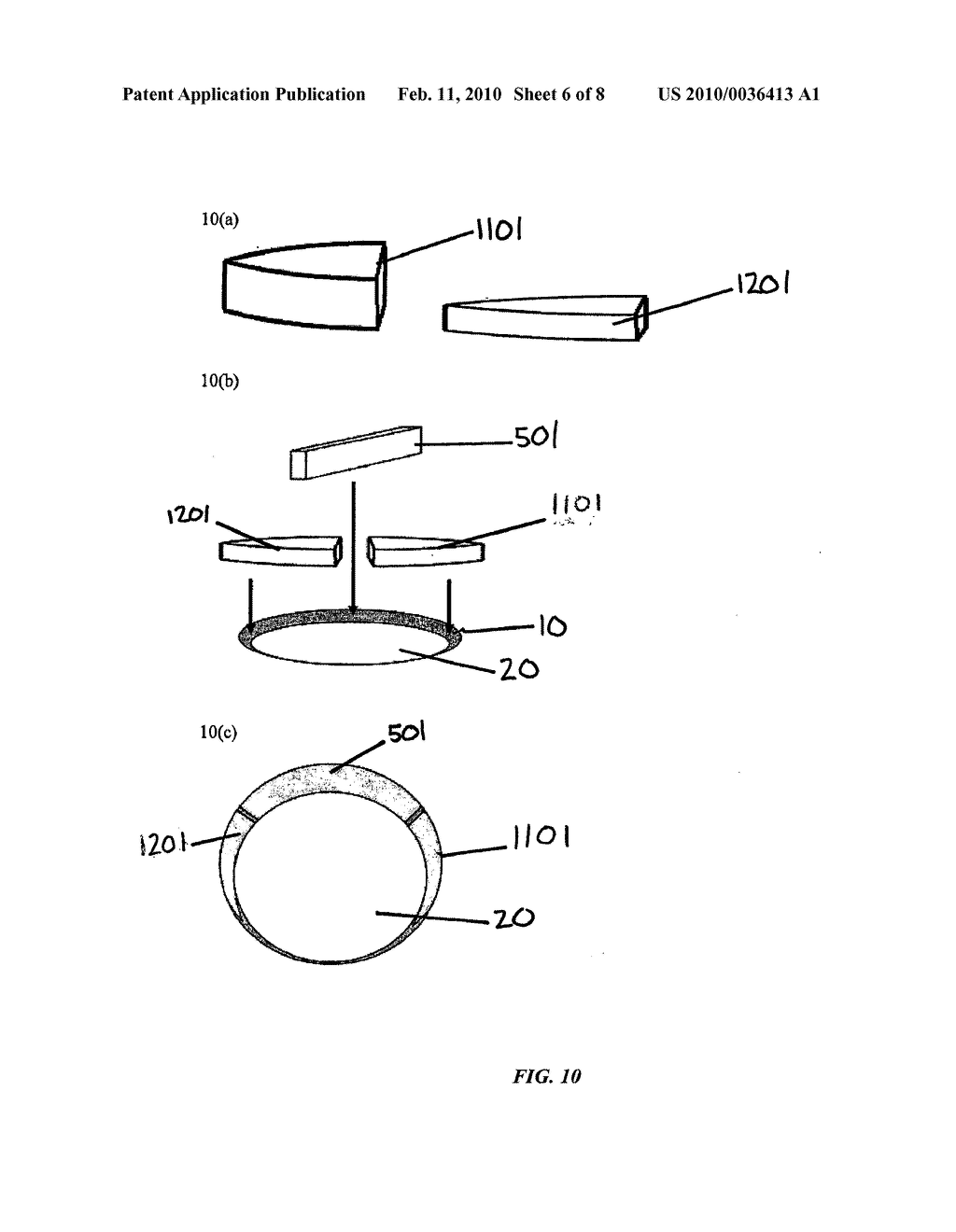 KERF CRANIAL CLOSURE METHODS AND DEVICE - diagram, schematic, and image 07