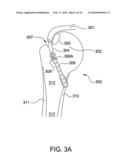 Suture-Retaining Device and Anchor diagram and image