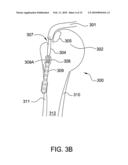 Suture-Retaining Device and Anchor diagram and image