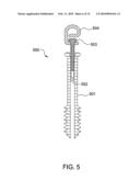 Suture-Retaining Device and Anchor diagram and image