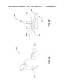 Suture-Retaining Device and Anchor diagram and image