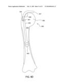 Suture-Retaining Device and Anchor diagram and image