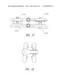 Spinous process device and method of use diagram and image