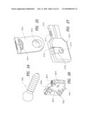 Spinous process device and method of use diagram and image