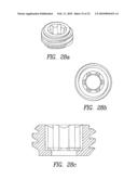 Spinous process device and method of use diagram and image