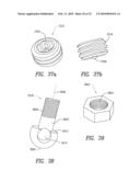 Spinous process device and method of use diagram and image