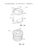 Spinous process device and method of use diagram and image