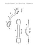 HEAD-TO-HEAD CONNECTOR SPINAL FIXATION SYSTEM diagram and image