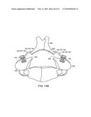 HEAD-TO-HEAD CONNECTOR SPINAL FIXATION SYSTEM diagram and image