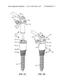 LOAD-SHARING COMPONENT HAVING A DEFLECTABLE POST AND METHOD FOR DYNAMIC STABILIZATION OF THE SPINE diagram and image