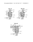 LOAD-SHARING COMPONENT HAVING A DEFLECTABLE POST AND METHOD FOR DYNAMIC STABILIZATION OF THE SPINE diagram and image