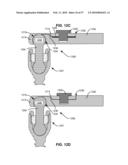 LOAD-SHARING COMPONENT HAVING A DEFLECTABLE POST AND METHOD FOR DYNAMIC STABILIZATION OF THE SPINE diagram and image