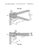 LOAD-SHARING COMPONENT HAVING A DEFLECTABLE POST AND METHOD FOR DYNAMIC STABILIZATION OF THE SPINE diagram and image