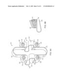 METHODS AND SYSTEMS FOR INCREASING THE BENDING STIFFNESS AND CONSTRAINING THE SPREADING OF A SPINAL SEGMENT diagram and image