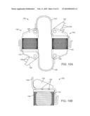 METHODS AND SYSTEMS FOR INCREASING THE BENDING STIFFNESS AND CONSTRAINING THE SPREADING OF A SPINAL SEGMENT diagram and image