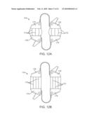 METHODS AND SYSTEMS FOR INCREASING THE BENDING STIFFNESS AND CONSTRAINING THE SPREADING OF A SPINAL SEGMENT diagram and image