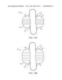 METHODS AND SYSTEMS FOR INCREASING THE BENDING STIFFNESS AND CONSTRAINING THE SPREADING OF A SPINAL SEGMENT diagram and image