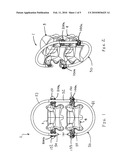 ANTI-TORSION SPINE FIXATION DEVICE diagram and image