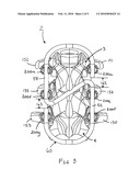 ANTI-TORSION SPINE FIXATION DEVICE diagram and image