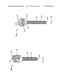 ANTI-TORSION SPINE FIXATION DEVICE diagram and image