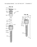 LOAD-SHARING BONE ANCHOR HAVING A DEFLECTABLE POST AND METHOD FOR STABILIZATION OF THE SPINE diagram and image