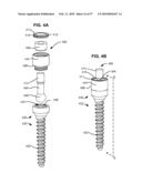 LOAD-SHARING BONE ANCHOR HAVING A DEFLECTABLE POST AND METHOD FOR STABILIZATION OF THE SPINE diagram and image