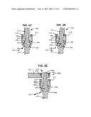 LOAD-SHARING BONE ANCHOR HAVING A DEFLECTABLE POST AND METHOD FOR STABILIZATION OF THE SPINE diagram and image