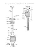 LOAD-SHARING BONE ANCHOR HAVING A DEFLECTABLE POST AND METHOD FOR STABILIZATION OF THE SPINE diagram and image