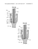 LOAD-SHARING BONE ANCHOR HAVING A DEFLECTABLE POST AND METHOD FOR STABILIZATION OF THE SPINE diagram and image