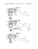 LOAD-SHARING BONE ANCHOR HAVING A DEFLECTABLE POST AND METHOD FOR STABILIZATION OF THE SPINE diagram and image