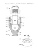 LOAD-SHARING BONE ANCHOR HAVING A DEFLECTABLE POST AND METHOD FOR STABILIZATION OF THE SPINE diagram and image