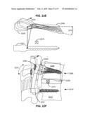 LOAD-SHARING BONE ANCHOR HAVING A DEFLECTABLE POST AND METHOD FOR STABILIZATION OF THE SPINE diagram and image