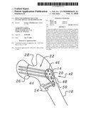 Bone end (Epiphysis) fracture fixation device and method of use diagram and image