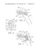 Bone end (Epiphysis) fracture fixation device and method of use diagram and image