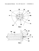 Bone end (Epiphysis) fracture fixation device and method of use diagram and image