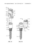 LOAD-SHARING BONE ANCHOR HAVING A DEFLECTABLE POST AND METHOD FOR DYNAMIC STABILIZATION OF THE SPINE diagram and image