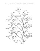 LOAD-SHARING BONE ANCHOR HAVING A DEFLECTABLE POST AND METHOD FOR DYNAMIC STABILIZATION OF THE SPINE diagram and image