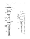 LOAD-SHARING BONE ANCHOR HAVING A DEFLECTABLE POST AND METHOD FOR DYNAMIC STABILIZATION OF THE SPINE diagram and image