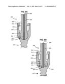 LOAD-SHARING BONE ANCHOR HAVING A DEFLECTABLE POST AND METHOD FOR DYNAMIC STABILIZATION OF THE SPINE diagram and image