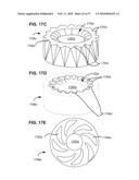 LOAD-SHARING BONE ANCHOR HAVING A DEFLECTABLE POST AND METHOD FOR DYNAMIC STABILIZATION OF THE SPINE diagram and image