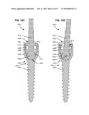 LOAD-SHARING BONE ANCHOR HAVING A DEFLECTABLE POST AND METHOD FOR DYNAMIC STABILIZATION OF THE SPINE diagram and image