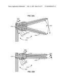 LOAD-SHARING BONE ANCHOR HAVING A DEFLECTABLE POST AND METHOD FOR DYNAMIC STABILIZATION OF THE SPINE diagram and image