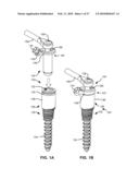 LOAD-SHARING BONE ANCHOR HAVING A DEFLECTABLE POST WITH A COMPLIANT RING AND METHOD FOR STABILIZATION OF THE SPINE diagram and image