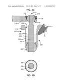 LOAD-SHARING BONE ANCHOR HAVING A DEFLECTABLE POST WITH A COMPLIANT RING AND METHOD FOR STABILIZATION OF THE SPINE diagram and image