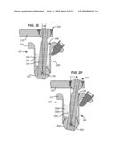 LOAD-SHARING BONE ANCHOR HAVING A DEFLECTABLE POST WITH A COMPLIANT RING AND METHOD FOR STABILIZATION OF THE SPINE diagram and image