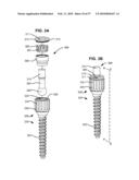 LOAD-SHARING BONE ANCHOR HAVING A DEFLECTABLE POST WITH A COMPLIANT RING AND METHOD FOR STABILIZATION OF THE SPINE diagram and image