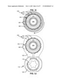 LOAD-SHARING BONE ANCHOR HAVING A DEFLECTABLE POST WITH A COMPLIANT RING AND METHOD FOR STABILIZATION OF THE SPINE diagram and image