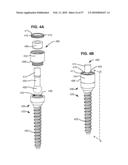 LOAD-SHARING BONE ANCHOR HAVING A DEFLECTABLE POST WITH A COMPLIANT RING AND METHOD FOR STABILIZATION OF THE SPINE diagram and image